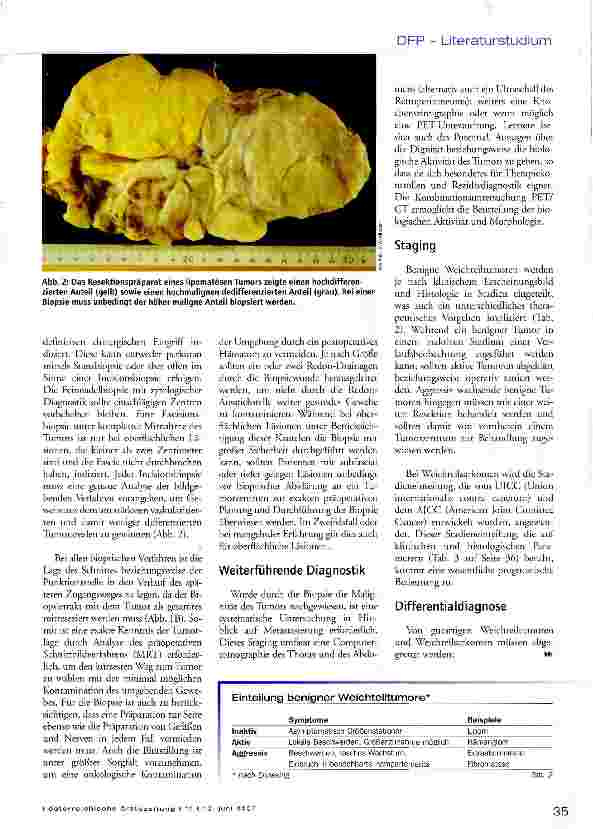 Vorschauseite 5: Weichteiltumore