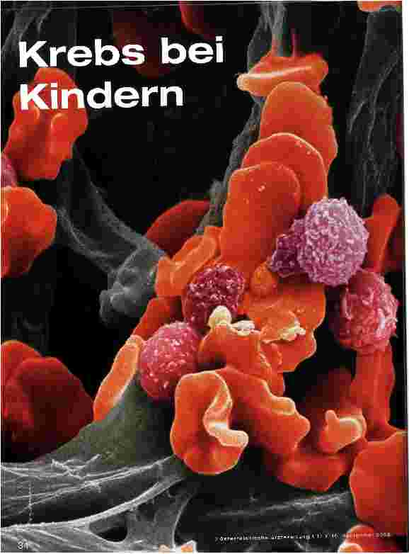Vorschauseite 1: Krebs bei Kindern