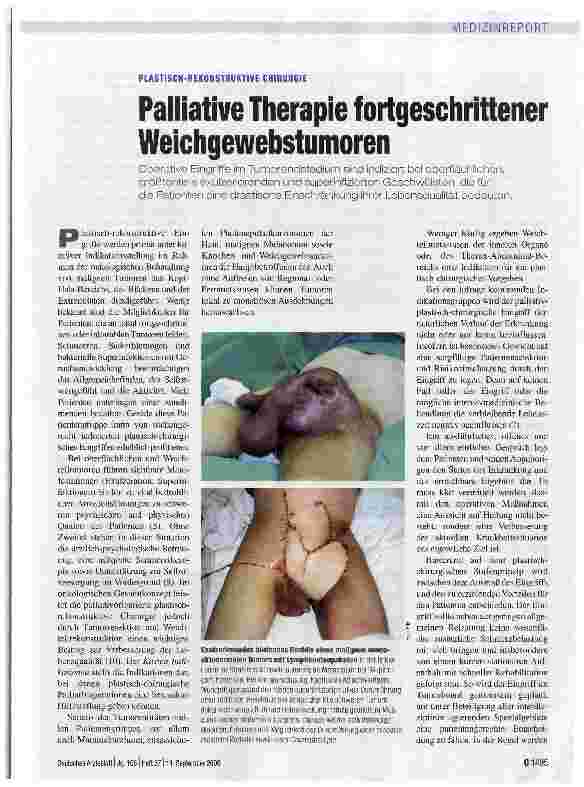 Vorschauseite 1: PLASTISCH-REKONSTRUKTIVE CHIRURGIE Palliative Therapie fortgeschrittener Weichgewebstumoren
