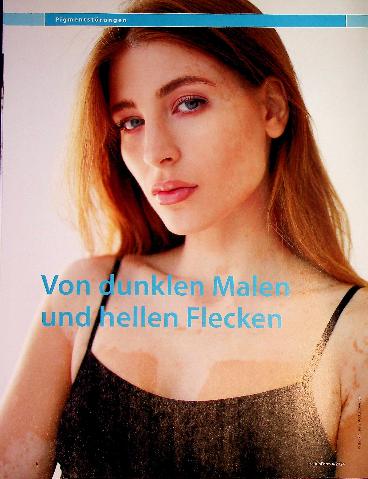 Vorschauseite 1: Von dunklen Malen und hellen Flecken