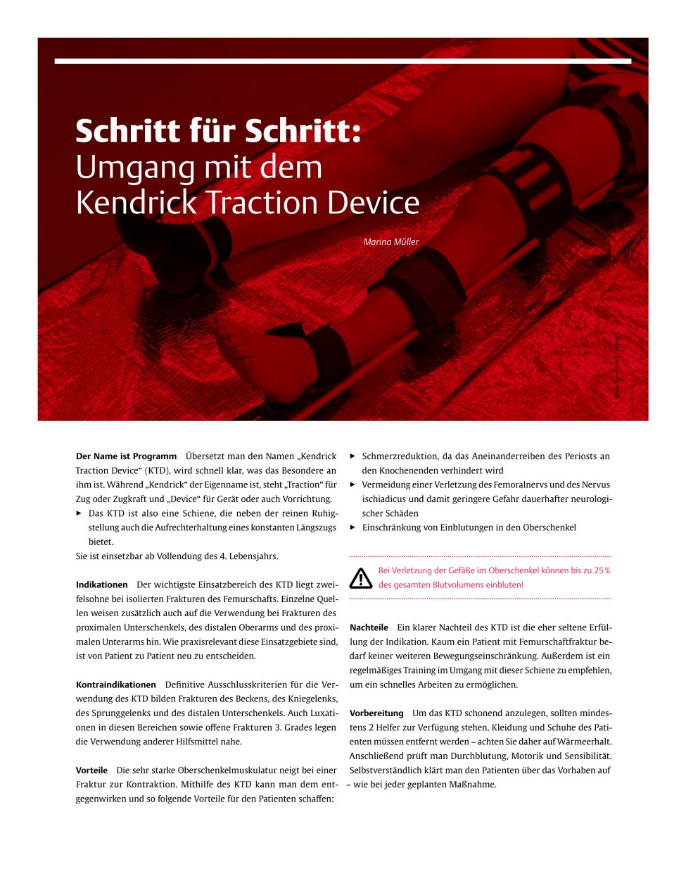 Vorschauseite 1: Schritt für Schritt: Umgang mit dem Kendrick Traction Device