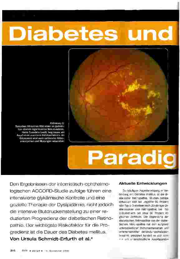 Vorschauseite 1: Diabetes und Auge: Paradigmenwechsel