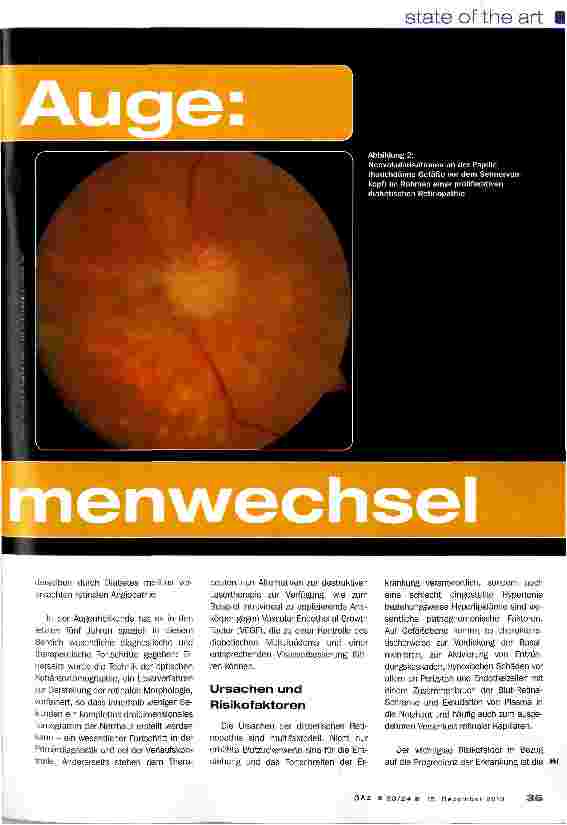 Vorschauseite 2: Diabetes und Auge: Paradigmenwechsel