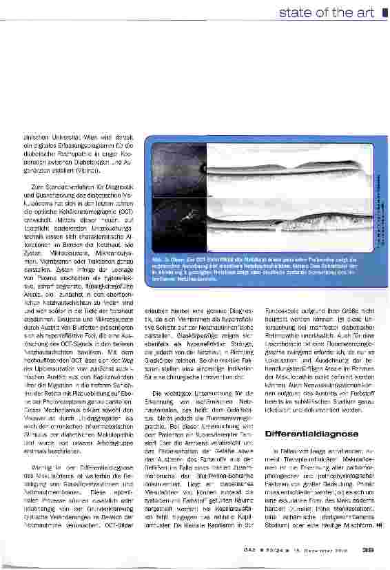 Vorschauseite 5: Diabetes und Auge: Paradigmenwechsel