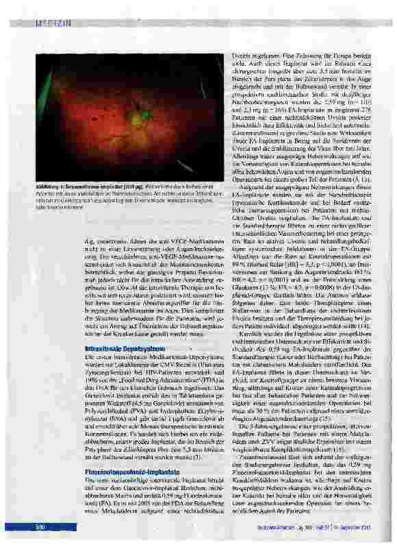 Vorschauseite 3: Therapiepotenzial intraokularer Steroid-Depotsysteme