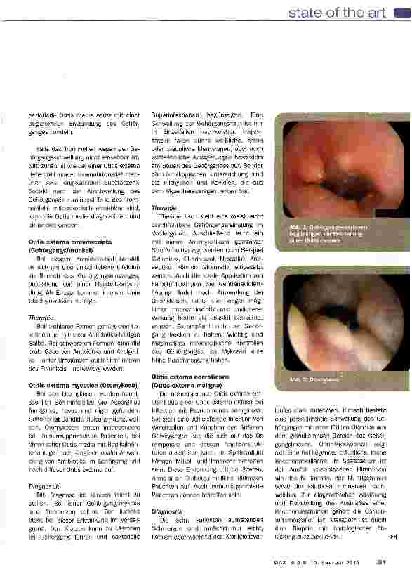 Vorschauseite 5: Otitis externa