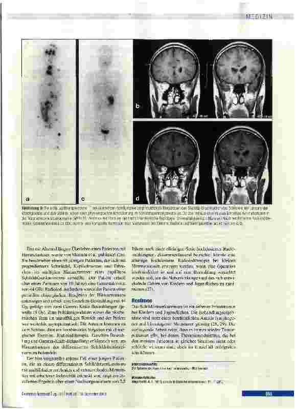 Vorschauseite 5: Zerebral metastasiertes Schilddrüsenkarzinom