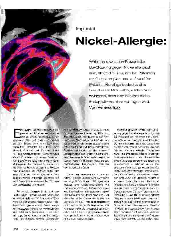 Vorschauseite 1: Nickel Allergie: kein Ausschlusskriterium