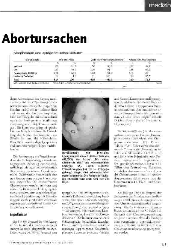 Vorschauseite 2: Embryoskopie ermittelt Abortursachen