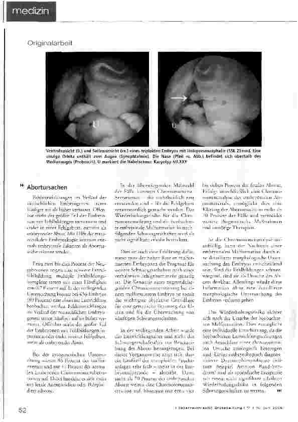 Vorschauseite 3: Embryoskopie ermittelt Abortursachen