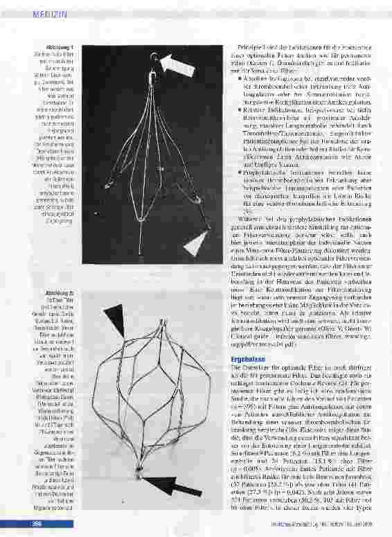 Vorschauseite 2: ÜBERSICHTSARBEITOptionale Vena-cava-FilterIndikationen, Management und Ergebnisse