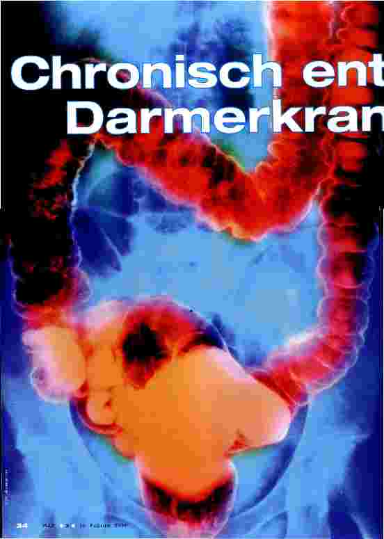 Vorschauseite 1: Chronisch entzündliche Darmerkrankung
