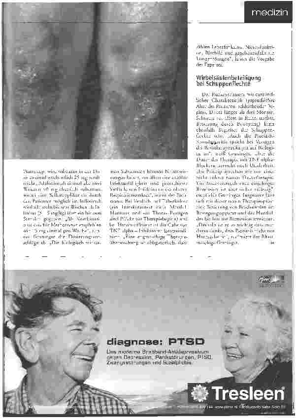 Vorschauseite 2: Psoriasis - Nicht nur Hautsache