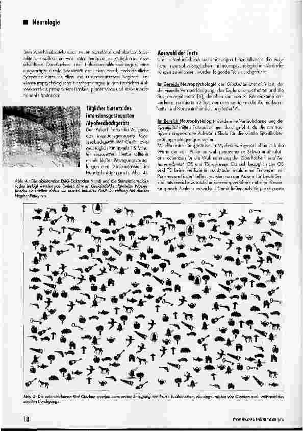 Vorschauseite 3: Einzelfallstudie: Elektromyografisch getriggertes Stimulationsgerät in der selbständigen häuslichen Anwendung