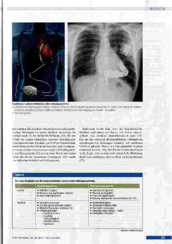 Vorschauseite 3: Situation der Herztransplantation und Weiterentwicklung von Kunstherzen