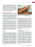 Vorschauseite 4: Zoonosen: Gefahr für den Menschen durch tierpathogene Erreger