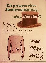 Vorschauseite 1: Die präoperative Stomamarkierung - ein "alter Hut"?