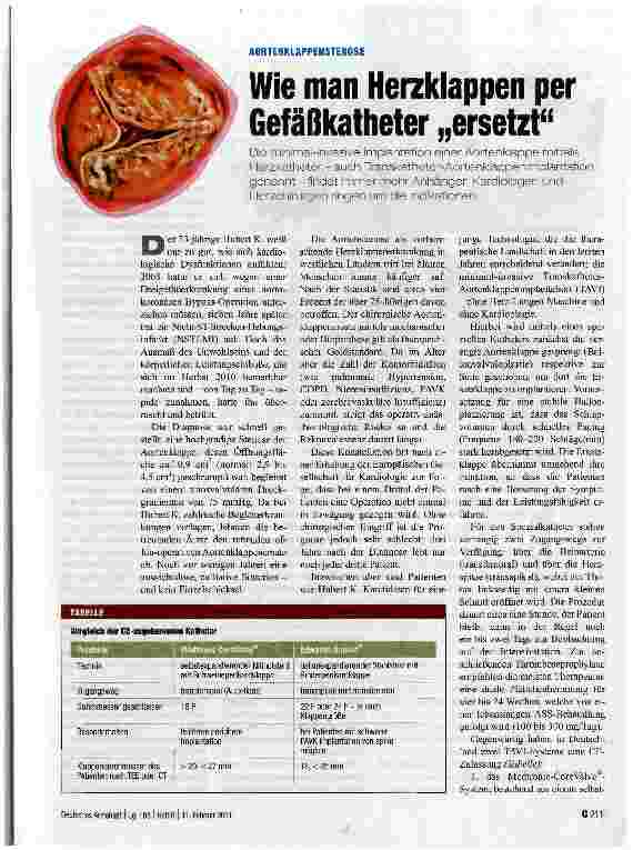 Vorschauseite 1: AORTENKLAPPENSTENOSEWie man Herzklappen per Gefäßkatheter „ersetzt