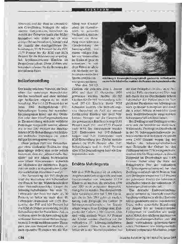Vorschauseite 3: Methoden der assistierten Reproduktion werden sicherer