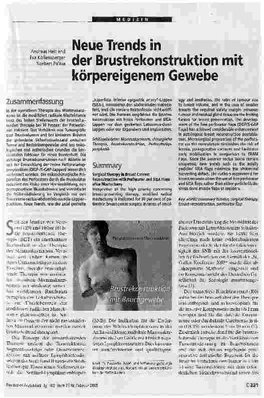Vorschauseite 1: Neue Trends in der Brustrekonstruktion mitkörpereigenem Gewebe