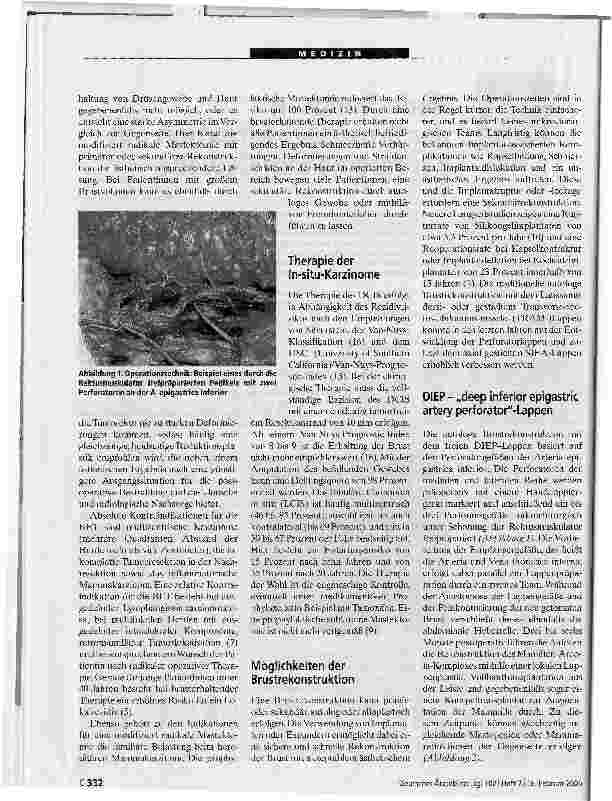 Vorschauseite 2: Neue Trends in der Brustrekonstruktion mitkörpereigenem Gewebe