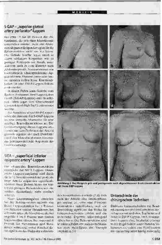 Vorschauseite 3: Neue Trends in der Brustrekonstruktion mitkörpereigenem Gewebe