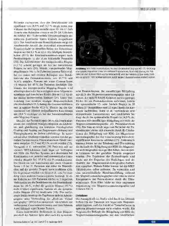 Vorschauseite 5: Detektion des Prostatakarzinoms