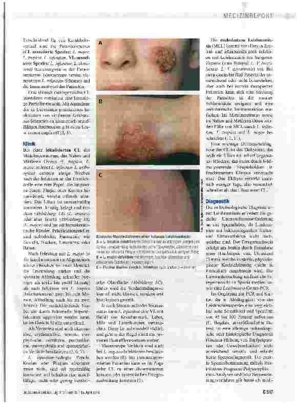 Vorschauseite 2: Kutane Leishmaniasis