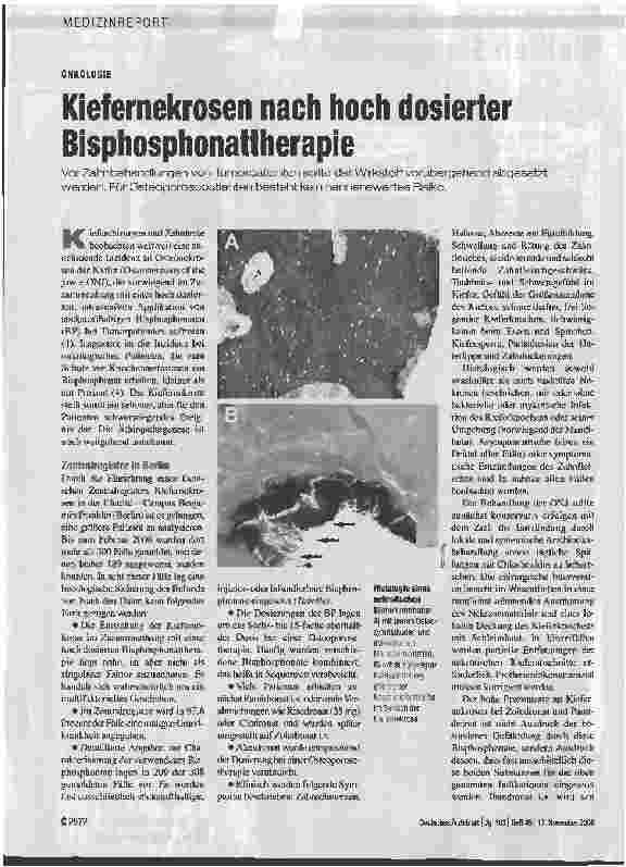 Vorschauseite 1: ONKOLOGIE - Kiefernekrosen nach hoch dosierter Bisphosphonattherapie