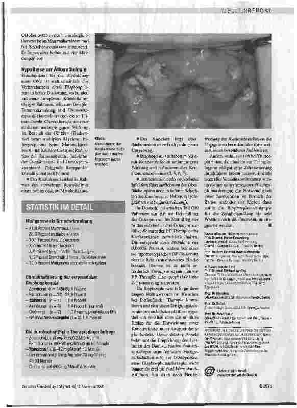 Vorschauseite 2: ONKOLOGIE - Kiefernekrosen nach hoch dosierter Bisphosphonattherapie