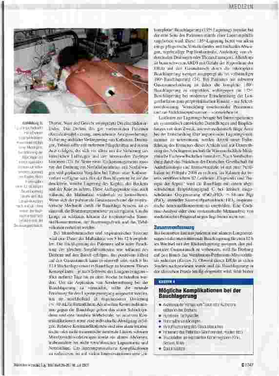 Vorschauseite 5: Beatmung in Bauchlage beim akuten Lungenversagen