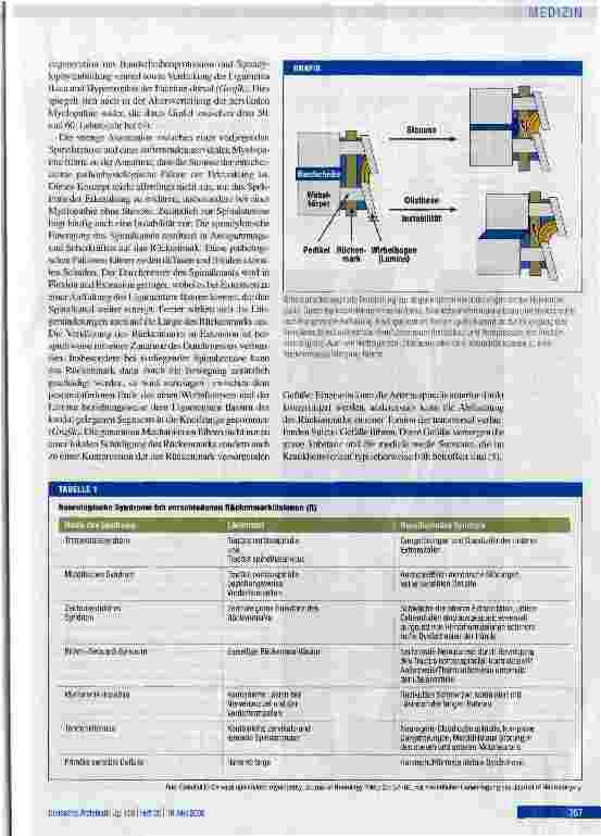 Vorschauseite 2: Die degenerative zervikale Spinalkanalstenose