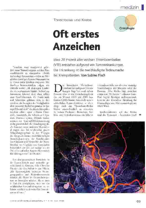 Vorschauseite 1: Oft erstes Anzeichen