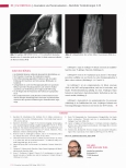 Vorschauseite 3: Anomalien und Normvarianten – Skelettale Veränderungen 3.22 Akzessorien der Fußwurzel medial und lateral