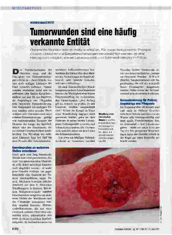 Vorschauseite 1: Tumorwunden sind eine häufig verkannte Entität