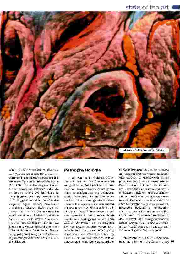 Vorschauseite 2: Zöliakie