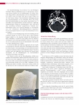 Vorschauseite 3: Radiochirurgie mit dem ZAP-X: Eine neue Möglichkeit für radiochirurgische Behandlungen.