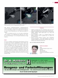 Vorschauseite 4: Radiochirurgie mit dem ZAP-X: Eine neue Möglichkeit für radiochirurgische Behandlungen.