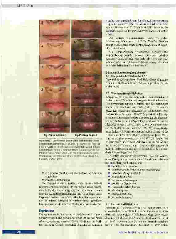 Vorschauseite 4: Diagnose des Fetalen Alkoholsyndroms