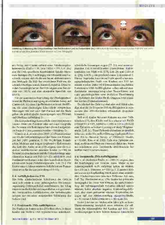 Vorschauseite 5: Diagnose des Fetalen Alkoholsyndroms