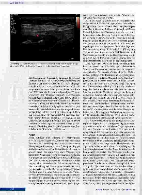 Vorschauseite 3: Stuhltransplantation bei therapiefrakturärer Clostridium-difficile-assoziierter Kolitis