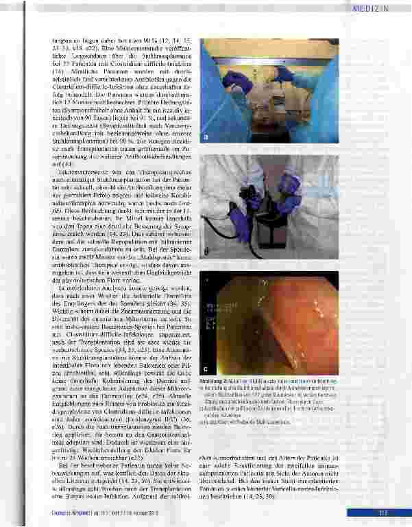 Vorschauseite 6: Stuhltransplantation bei therapiefrakturärer Clostridium-difficile-assoziierter Kolitis