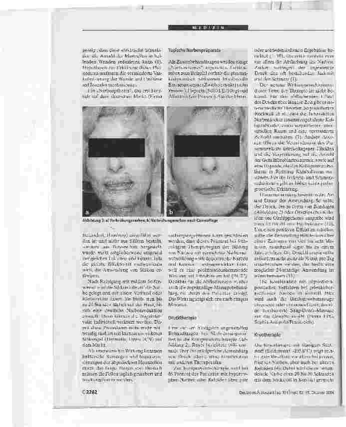Vorschauseite 5: Narbentherapie in der Dermatologie