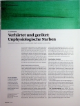 Vorschauseite 1: Verhärtet und gerötet: Unphysiologische Narben
