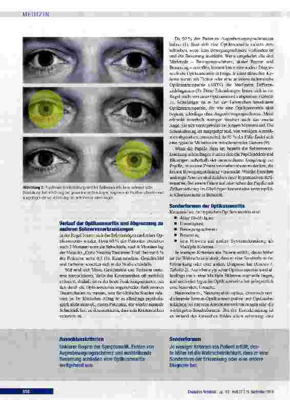 Vorschauseite 3: Diagnostik und Therapie der Optikusneuritis