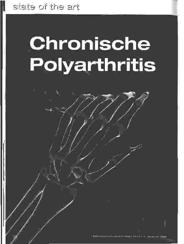 Vorschauseite 1: Chronische Polyarthritis