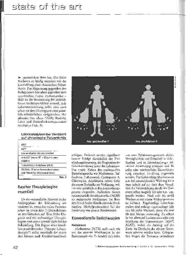 Vorschauseite 4: Chronische Polyarthritis