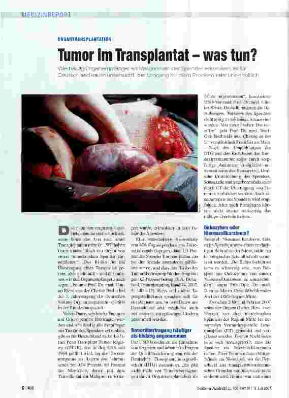 Vorschauseite 1: Tumor im Transplantat - was tun?