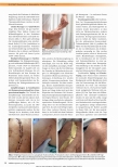 Vorschauseite 2: Physiotherapie zur Narbenreduktion - Effektivität und Grenzen