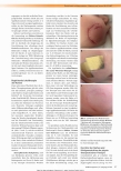 Vorschauseite 3: Physiotherapie zur Narbenreduktion - Effektivität und Grenzen